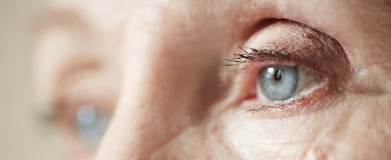 Sadighi ophtalmologue Cataracte