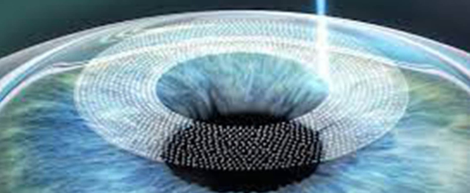 Sadighi ophtalmologue Femto-Lasik