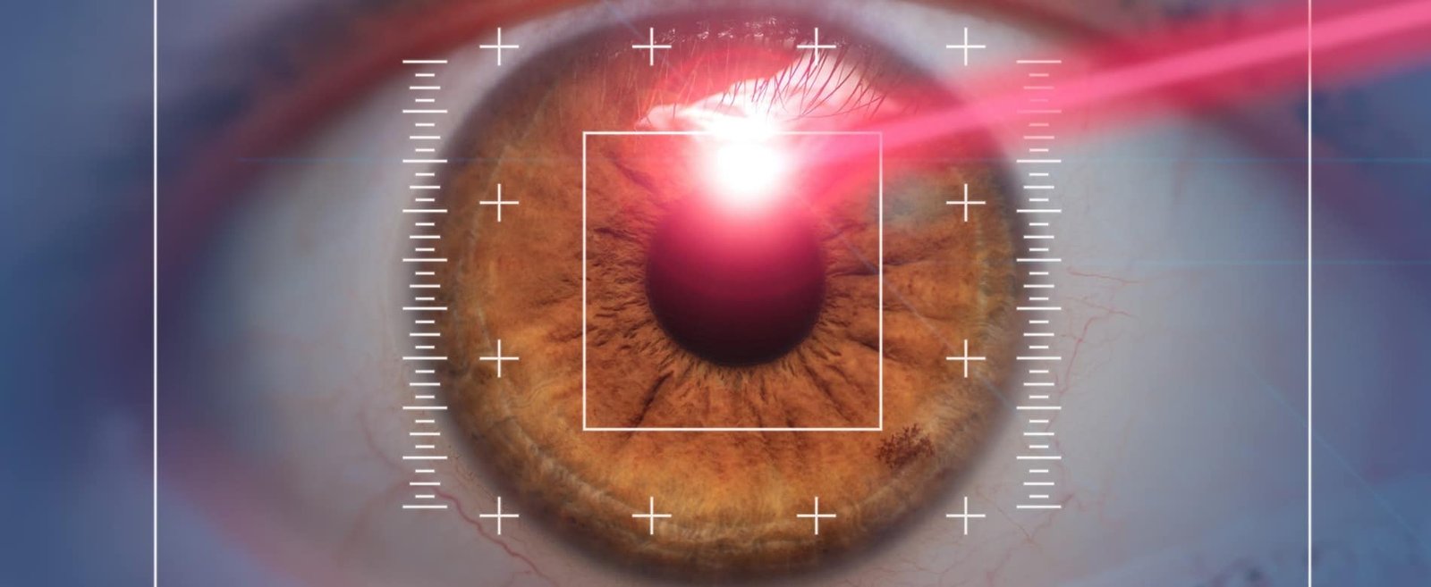 Sadighi ophtalmologue PKR