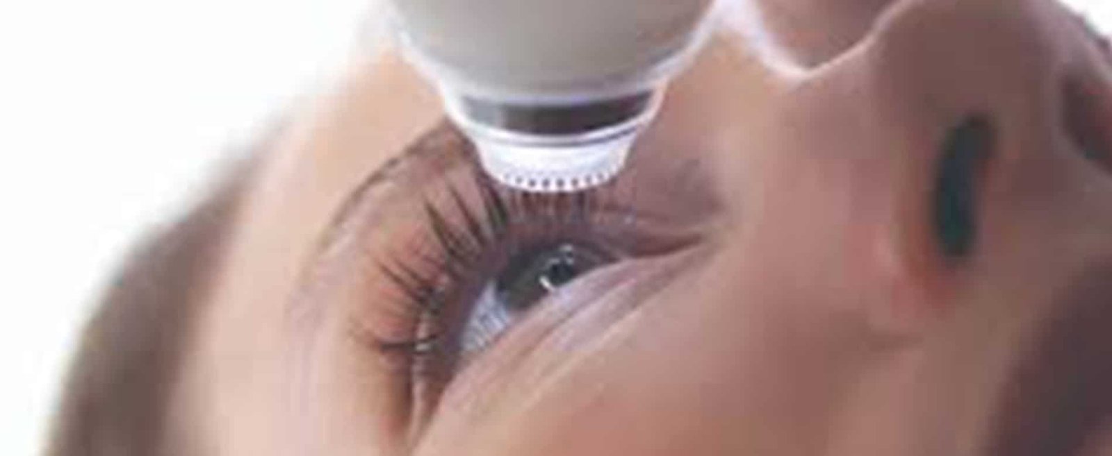 Sadighi ophtalmologue Smile